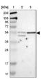 Zona pellucida sperm-binding protein 4 antibody, NBP1-86823, Novus Biologicals, Western Blot image 