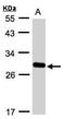 Yip1 Domain Family Member 4 antibody, TA309041, Origene, Western Blot image 