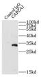 Capping Actin Protein Of Muscle Z-Line Subunit Alpha 1 antibody, FNab01255, FineTest, Immunoprecipitation image 