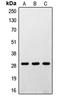Ribosomal Protein S4 Y-Linked 1 antibody, LS-C352802, Lifespan Biosciences, Western Blot image 