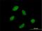 RNA Polymerase III Subunit C antibody, H00010623-B03P, Novus Biologicals, Immunofluorescence image 