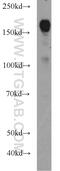 Protein LAP2 antibody, 22438-1-AP, Proteintech Group, Western Blot image 