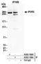 Inositol 1,4,5-trisphosphate receptor type 3 antibody, A302-159A, Bethyl Labs, Immunoprecipitation image 