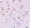 Nanos C2HC-Type Zinc Finger 1 antibody, PA5-20556, Invitrogen Antibodies, Immunohistochemistry paraffin image 