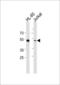 RUNX Family Transcription Factor 3 antibody, LS-C162814, Lifespan Biosciences, Western Blot image 