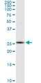 RING finger protein 170 antibody, H00081790-M01, Novus Biologicals, Western Blot image 