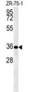 Zinc finger protein DPF3 antibody, abx032520, Abbexa, Western Blot image 