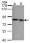 Calpain 5 antibody, LS-C185533, Lifespan Biosciences, Western Blot image 