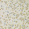 Adenylosuccinate synthetase isozyme 2 antibody, 14-399, ProSci, Immunohistochemistry paraffin image 