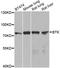 Bruton Tyrosine Kinase antibody, LS-C747820, Lifespan Biosciences, Western Blot image 