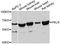 Pyruvate Kinase L/R antibody, LS-C747278, Lifespan Biosciences, Western Blot image 