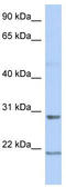 PILR Alpha Associated Neural Protein antibody, TA337823, Origene, Western Blot image 