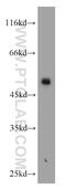 Keratin 8 antibody, 10384-1-AP, Proteintech Group, Western Blot image 
