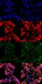 7-Ketocholesterol antibody, MA5-27561, Invitrogen Antibodies, Immunofluorescence image 