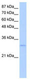 Exosome Component 6 antibody, TA343971, Origene, Western Blot image 