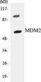 MDM2 Proto-Oncogene antibody, EKC1357, Boster Biological Technology, Western Blot image 