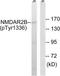 Glutamate Ionotropic Receptor NMDA Type Subunit 2B antibody, TA313307, Origene, Western Blot image 