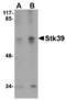 STE20/SPS1-related proline-alanine-rich protein kinase antibody, A02516, Boster Biological Technology, Western Blot image 
