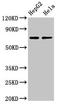 Autocrine Motility Factor Receptor antibody, LS-C669761, Lifespan Biosciences, Western Blot image 