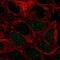 Pep4 antibody, NBP2-68931, Novus Biologicals, Immunocytochemistry image 