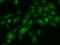 Probable ATP-dependent RNA helicase DDX59 antibody, 202504-T02, Sino Biological, Immunohistochemistry paraffin image 