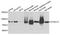 Cytoplasmic dynein 1 intermediate chain 1 antibody, STJ23452, St John