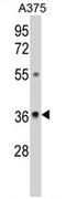 UDP-Galactose-4-Epimerase antibody, AP17410PU-N, Origene, Western Blot image 