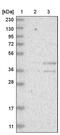Neuraminidase 1 antibody, PA5-54430, Invitrogen Antibodies, Western Blot image 