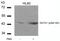 GATA Binding Protein 1 antibody, PA5-37581, Invitrogen Antibodies, Western Blot image 