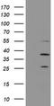 Proteasome Subunit Beta 7 antibody, CF504429, Origene, Western Blot image 