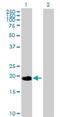 NME/NM23 Nucleoside Diphosphate Kinase 6 antibody, H00010201-B02P, Novus Biologicals, Western Blot image 