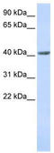 SET and MYND domain-containing protein 3 antibody, TA339750, Origene, Western Blot image 