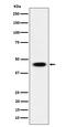 Adenylosuccinate synthetase isozyme 2 antibody, M07539, Boster Biological Technology, Western Blot image 