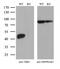 VRK Serine/Threonine Kinase 1 antibody, M03396, Boster Biological Technology, Western Blot image 