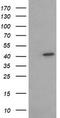 3-ketoacyl-CoA thiolase, mitochondrial antibody, TA506154AM, Origene, Western Blot image 