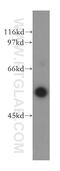 EMAP Like 2 antibody, 13529-1-AP, Proteintech Group, Western Blot image 