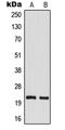 TM2 Domain Containing 1 antibody, GTX55976, GeneTex, Western Blot image 