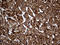 Cytochrome b-c1 complex subunit Rieske, mitochondrial antibody, M08781, Boster Biological Technology, Immunohistochemistry paraffin image 
