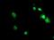 Adrenocortical dysplasia protein antibody, NBP2-01851, Novus Biologicals, Immunocytochemistry image 