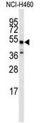 ADRB2 antibody, AP13973PU-N, Origene, Western Blot image 