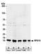 Ribosomal Protein S19 antibody, A304-002A, Bethyl Labs, Western Blot image 