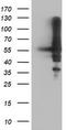 Protein kinase B antibody, TA504235S, Origene, Western Blot image 