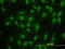 HsMAD2 antibody, LS-C133304, Lifespan Biosciences, Immunofluorescence image 