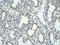 Bromodomain Containing 7 antibody, ARP39018_P050, Aviva Systems Biology, Immunohistochemistry paraffin image 