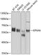 Karyopherin Subunit Alpha 6 antibody, GTX55687, GeneTex, Western Blot image 