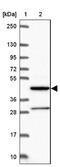 Man1a antibody, NBP2-38030, Novus Biologicals, Western Blot image 