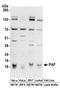 PCNA Clamp Associated Factor antibody, A304-374A, Bethyl Labs, Western Blot image 