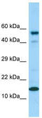 Cyclin-dependent kinase 2-associated protein 1 antibody, TA338183, Origene, Western Blot image 