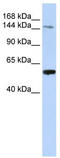 Enhancer Of MRNA Decapping 4 antibody, TA334516, Origene, Western Blot image 