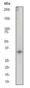 F11 Receptor antibody, ab52647, Abcam, Western Blot image 